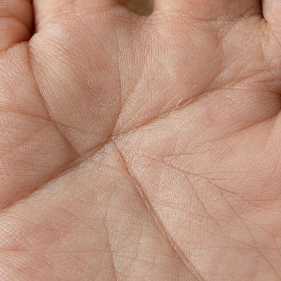 Palm skin seen very close, with small crossing creases and a tiny island